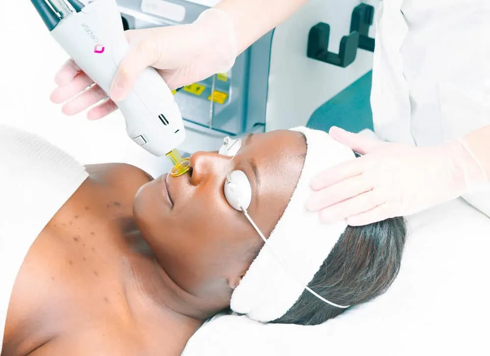 Laser Hair Removal
