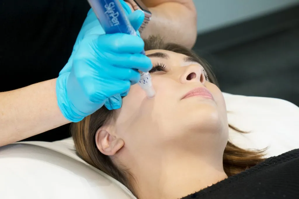 Microneedling / SkinPen