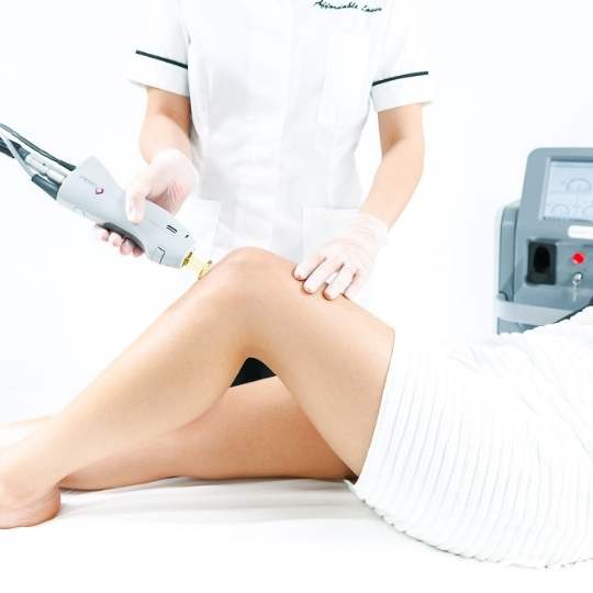 Laser Vein Treatment